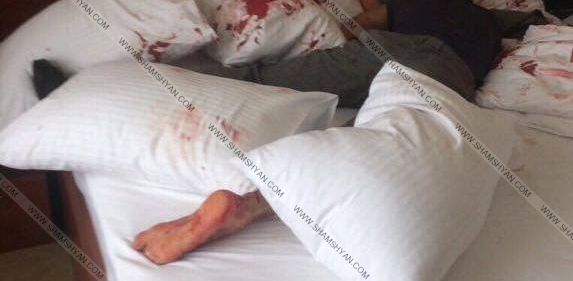 Արտակարգ դեպք Երևանում. «Անի Պլազա» հյուրանոցում հայտնաբերվել է Վրաստանի 24-ամյա քաղաքացու դի