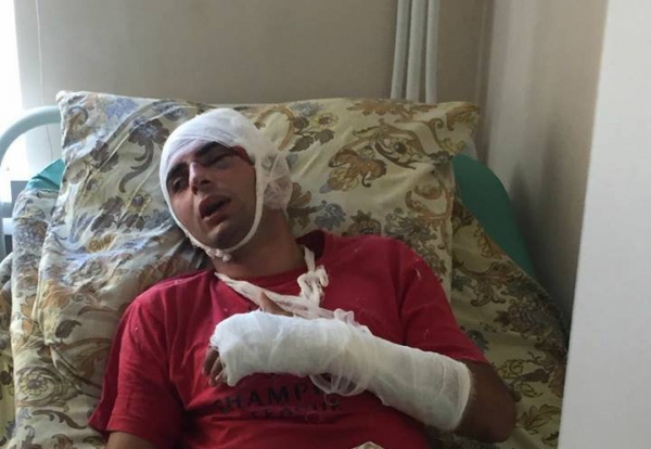 Աբխազիայում հայ պետավտոտեսուչին դաժան ծեծի են ենթարկել և կտրել ականջը