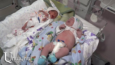 Գյումրու ծննդատանը ռեկորդային քաշով տղա է ծնվել 