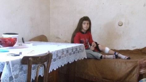 Թափառող շունը հարձակվել և կծել է երեխային 