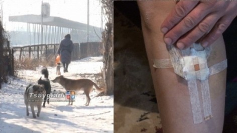 Շների խմբակային հարձակում Գյումրիում