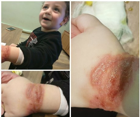 Ինձ չեմ կարողանում ներել, որ երեխայիս վնասած բժիշկներն անպատիժ են մնալու...