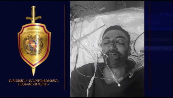 Տղամարդն անգիտակից վիճակում տեղափոխվել է հիվանդանոց. ճանաչողներին խնդրում ենք ահազանգել 1-02