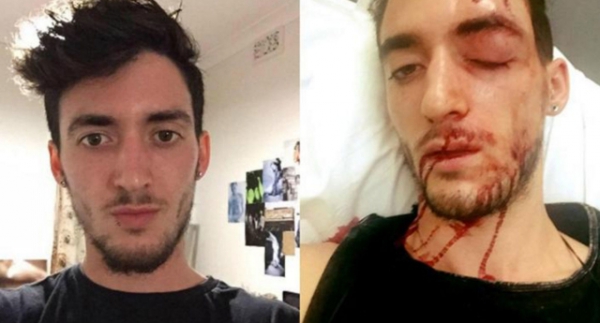 ՄԻՊ-ն՝ Արցախում «ֆրանսահայ համասեռամոլին ծեծի ենթարկելու» լուրերի մասին